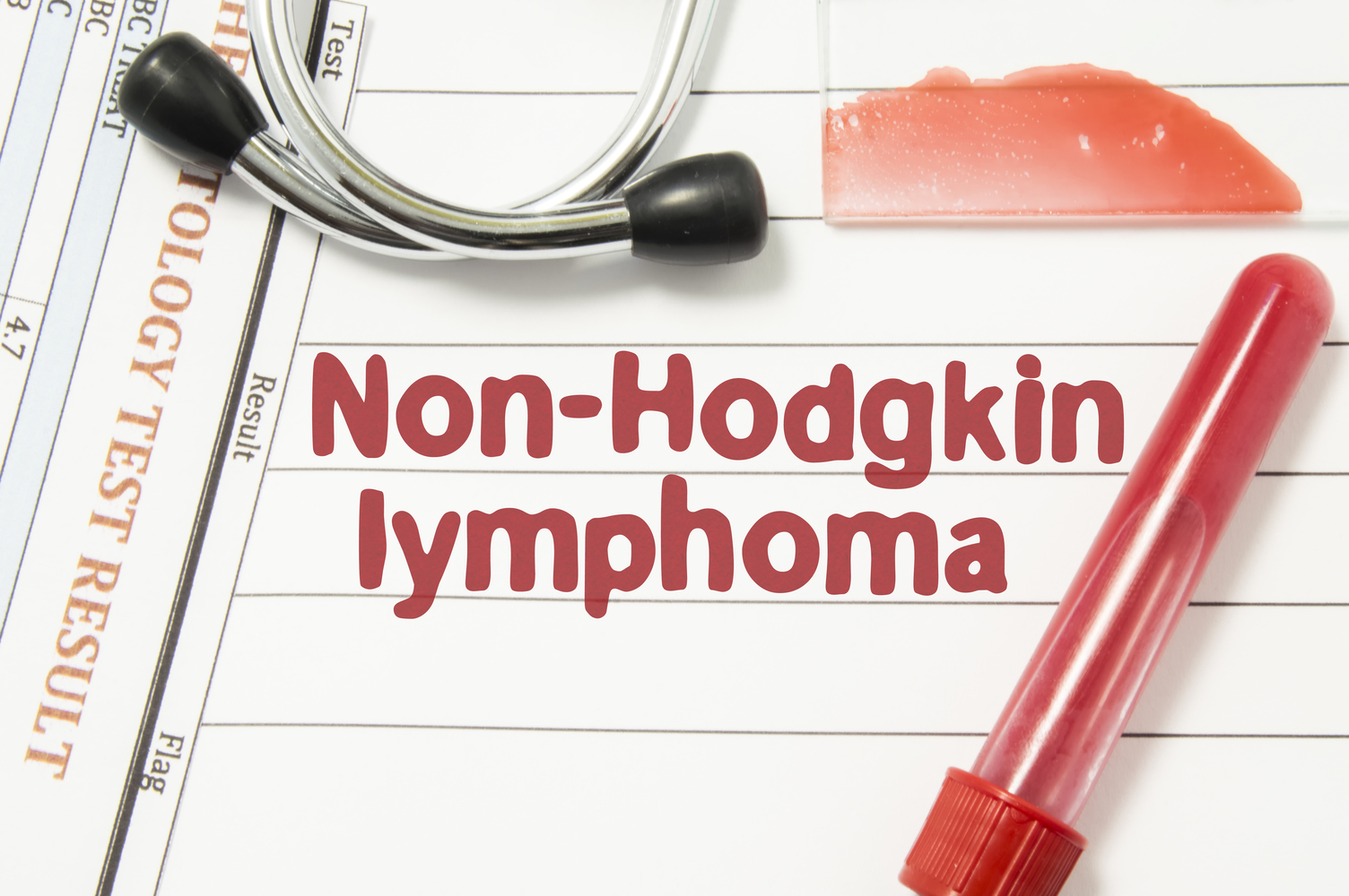 Causes Triggering Non-Hodgkin’s Lymphoma