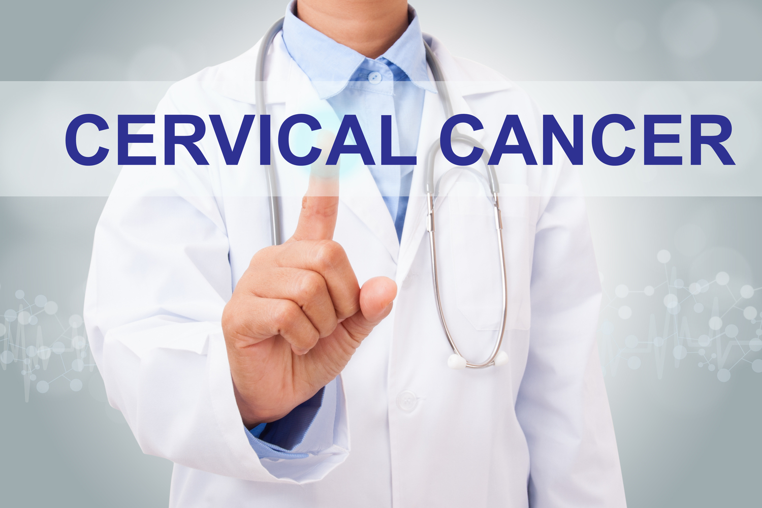 Treatment Options for Cervical Cancer According to Different Stages