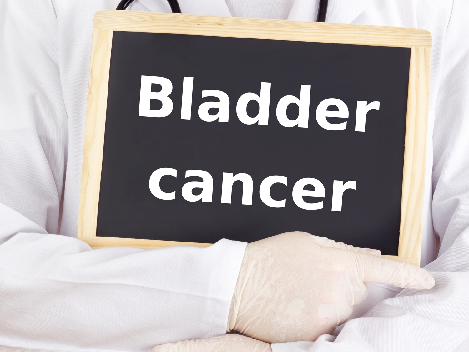 5 Common Bladder Cancer Treatments