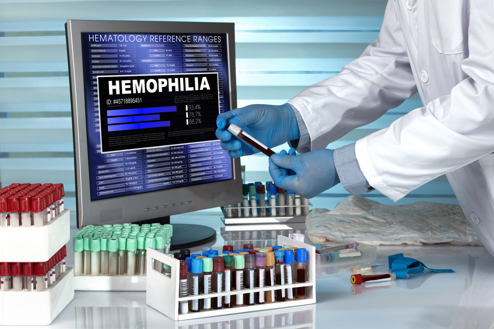 5 Common Symptoms of Hemophilia