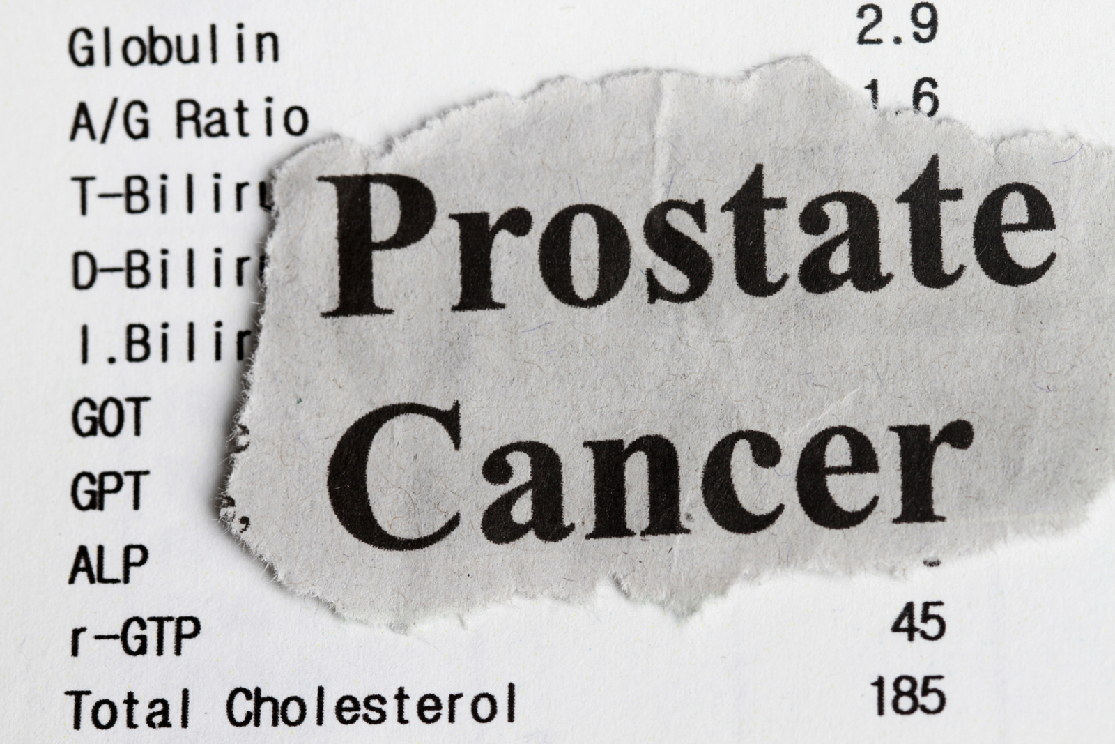 4 Early Symptoms of Prostate Cancer